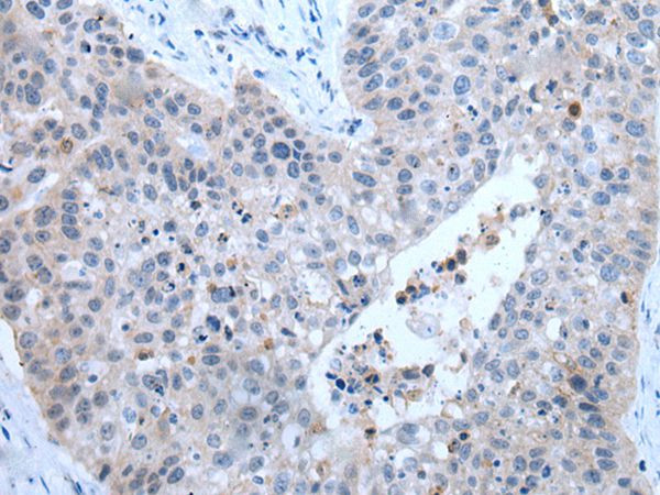ZDHHC5 Antibody in Immunohistochemistry (Paraffin) (IHC (P))