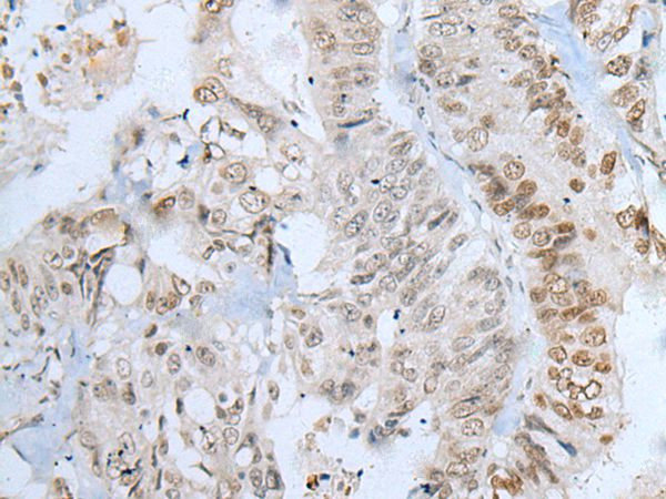 ZNF143 Antibody in Immunohistochemistry (Paraffin) (IHC (P))