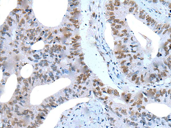 ZNF76 Antibody in Immunohistochemistry (Paraffin) (IHC (P))