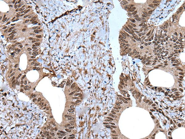ZNF787 Antibody in Immunohistochemistry (Paraffin) (IHC (P))