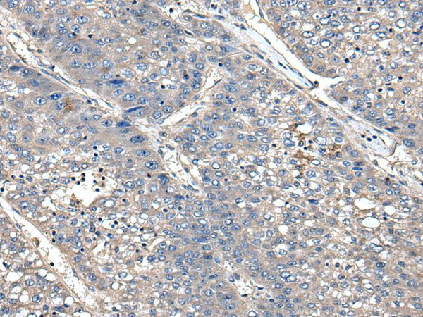 XDH Antibody in Immunohistochemistry (Paraffin) (IHC (P))