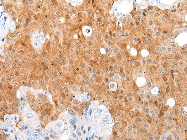 AKIP1 Antibody in Immunohistochemistry (Paraffin) (IHC (P))