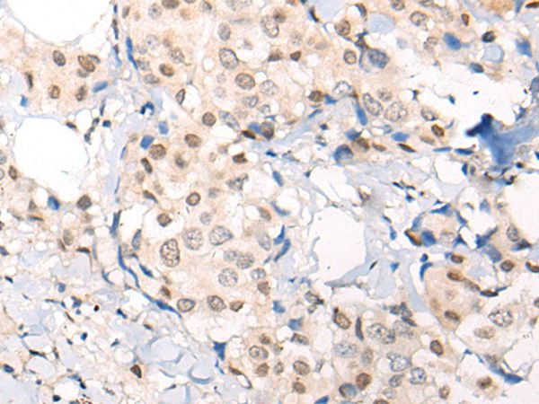 VPS51 Antibody in Immunohistochemistry (Paraffin) (IHC (P))
