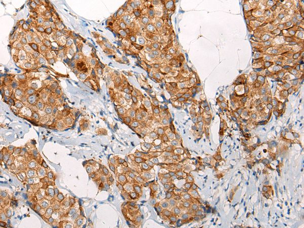 EMC7 Antibody in Immunohistochemistry (Paraffin) (IHC (P))