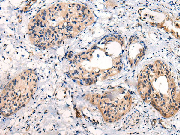 CP045 Antibody in Immunohistochemistry (Paraffin) (IHC (P))