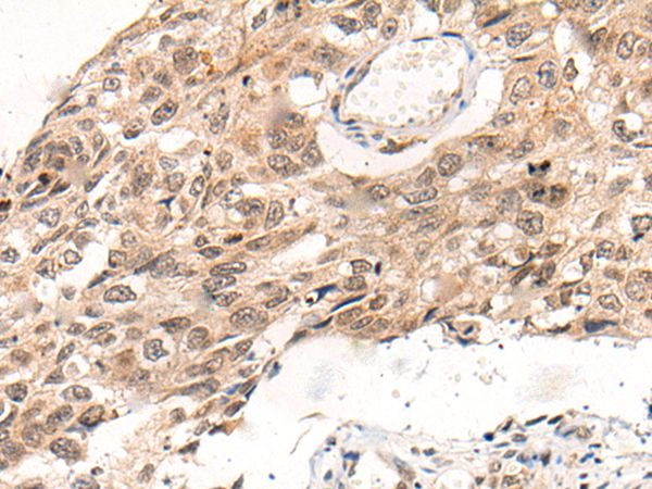 KNOP1 Antibody in Immunohistochemistry (Paraffin) (IHC (P))