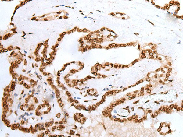 PIF1 Antibody in Immunohistochemistry (Paraffin) (IHC (P))