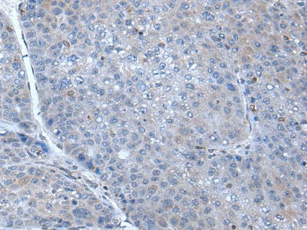 HIN-1 Antibody in Immunohistochemistry (Paraffin) (IHC (P))