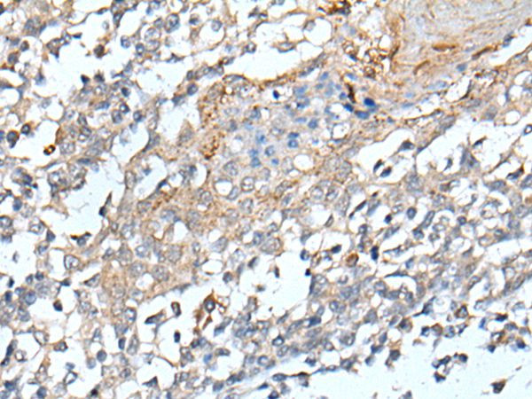 STARD4 Antibody in Immunohistochemistry (Paraffin) (IHC (P))