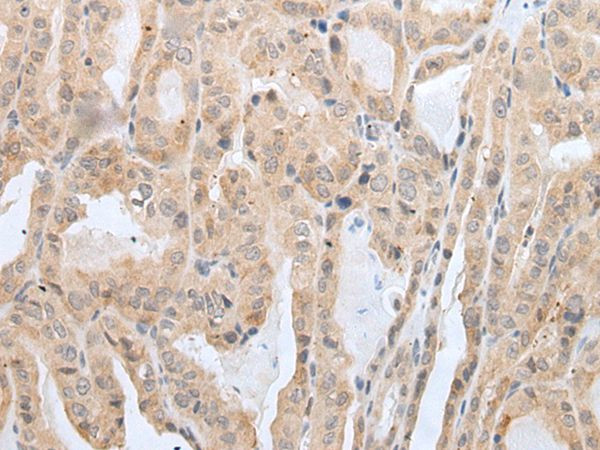 PRH2 Antibody in Immunohistochemistry (Paraffin) (IHC (P))