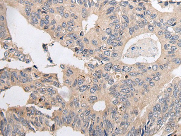 ARL5A Antibody in Immunohistochemistry (Paraffin) (IHC (P))
