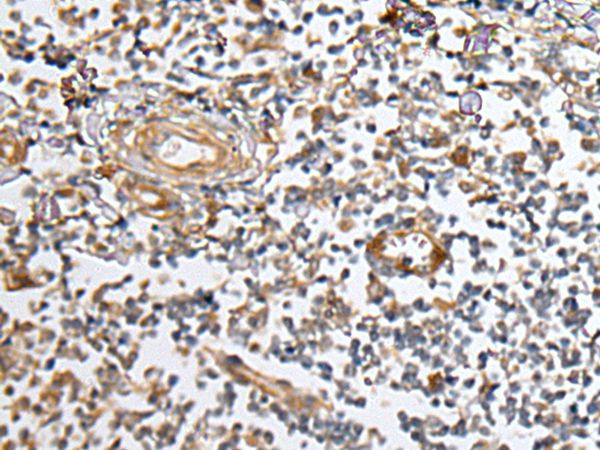 CUBN Antibody in Immunohistochemistry (Paraffin) (IHC (P))