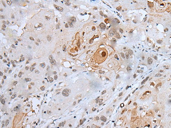 HOXC4 Antibody in Immunohistochemistry (Paraffin) (IHC (P))