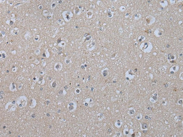 IL9R Antibody in Immunohistochemistry (Paraffin) (IHC (P))