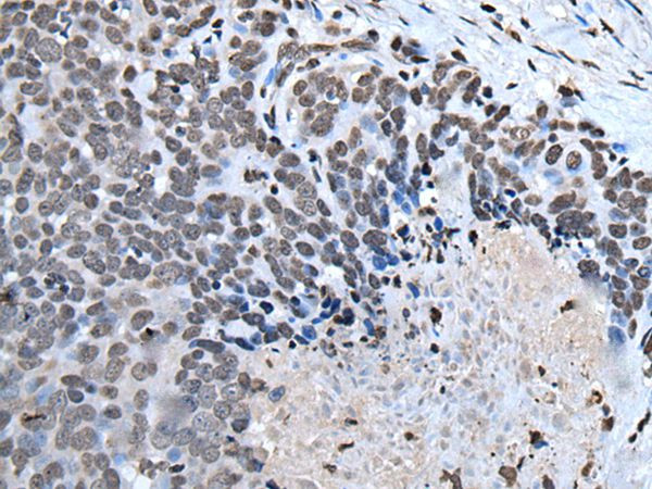HOXD1 Antibody in Immunohistochemistry (Paraffin) (IHC (P))
