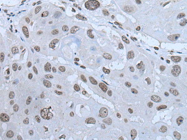 HAND1 Antibody in Immunohistochemistry (Paraffin) (IHC (P))