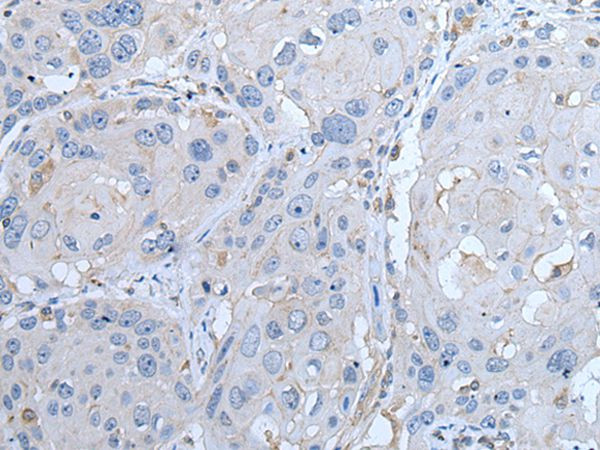 LTBP4 Antibody in Immunohistochemistry (Paraffin) (IHC (P))