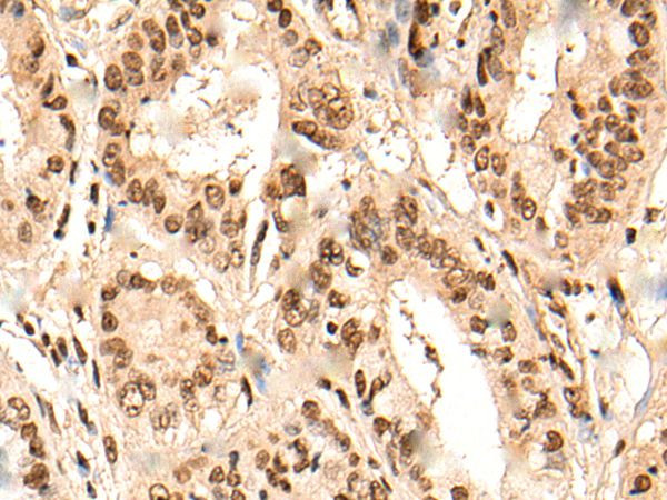 RMP Antibody in Immunohistochemistry (Paraffin) (IHC (P))