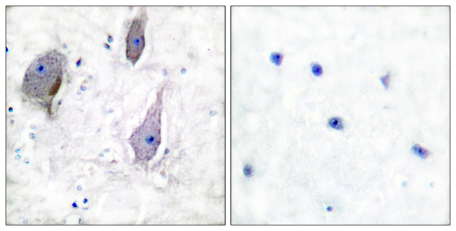 PMP22 Antibody in Immunohistochemistry (Paraffin) (IHC (P))