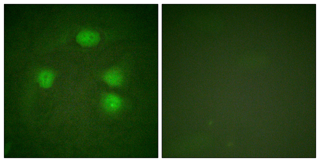 Kir3.1 (KCNJ3) Antibody in Immunocytochemistry (ICC/IF)