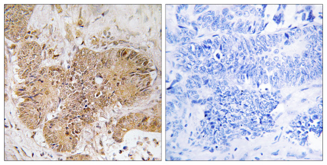 LUC7L2 Antibody in Immunohistochemistry (Paraffin) (IHC (P))
