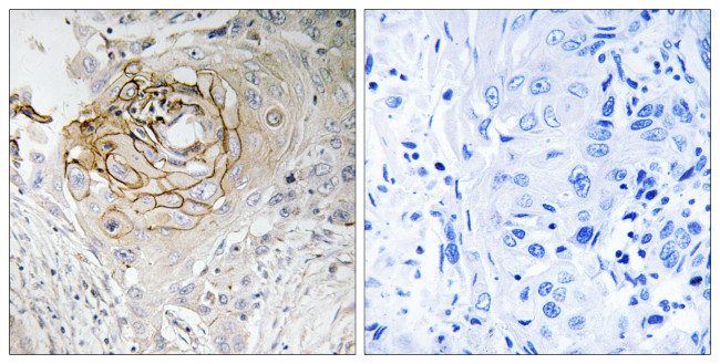 SCN9A Antibody in Immunohistochemistry (Paraffin) (IHC (P))