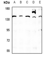 SIK3 Antibody in Western Blot (WB)