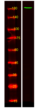 ZMYM4 Antibody in Western Blot (WB)