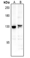 PPP1R9B Antibody in Western Blot (WB)