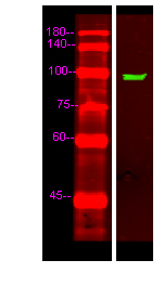 UNC5C Antibody in Western Blot (WB)