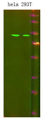 SPINK7 Antibody in Western Blot (WB)