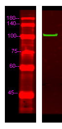 MYOCD Antibody in Western Blot (WB)