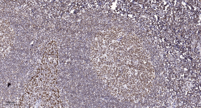 ALKBH5 Antibody in Immunohistochemistry (Paraffin) (IHC (P))