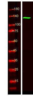 TAOK2 Antibody in Western Blot (WB)