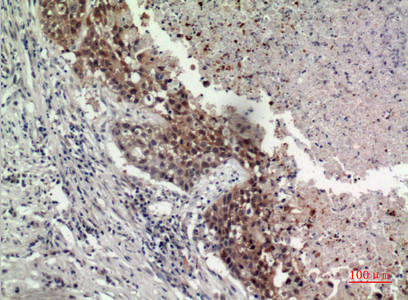GPR87 Antibody in Immunohistochemistry (Paraffin) (IHC (P))