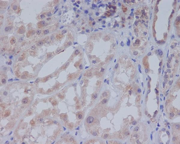 ACACB Antibody in Immunohistochemistry (Paraffin) (IHC (P))