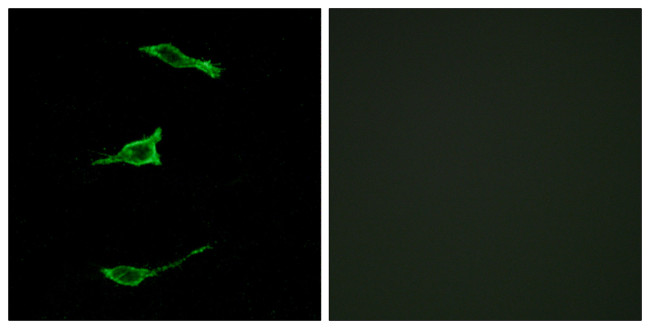 GPR40 Antibody in Immunocytochemistry (ICC/IF)