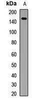 ZFYVE9 Antibody in Western Blot (WB)
