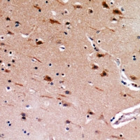 MEMO1 Antibody in Immunohistochemistry (Paraffin) (IHC (P))