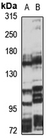 NPC1L1 Antibody in Western Blot (WB)