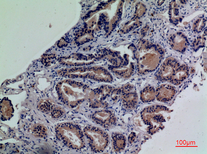 CD203c Antibody in Immunohistochemistry (Paraffin) (IHC (P))