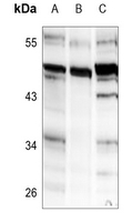 COLQ Antibody in Western Blot (WB)