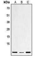 beta-Defensin 1 Antibody in Western Blot (WB)