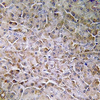 SEMA3C Antibody in Immunohistochemistry (Paraffin) (IHC (P))