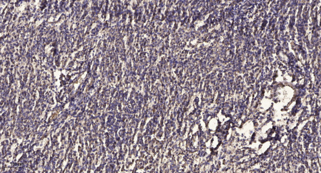 SEMA3F Antibody in Immunohistochemistry (Paraffin) (IHC (P))