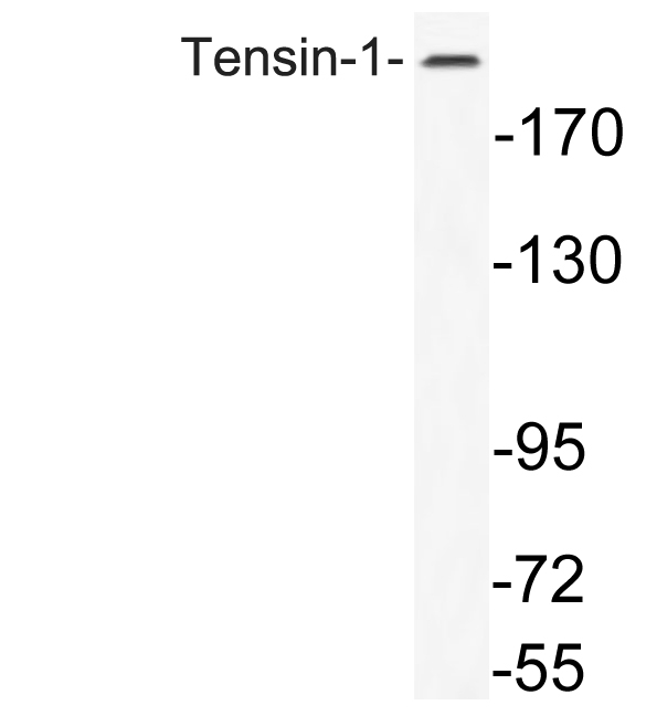 Tensin 1 Antibody in Western Blot (WB)