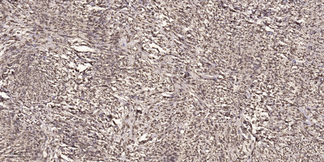 CABLES1 Antibody in Immunohistochemistry (Paraffin) (IHC (P))