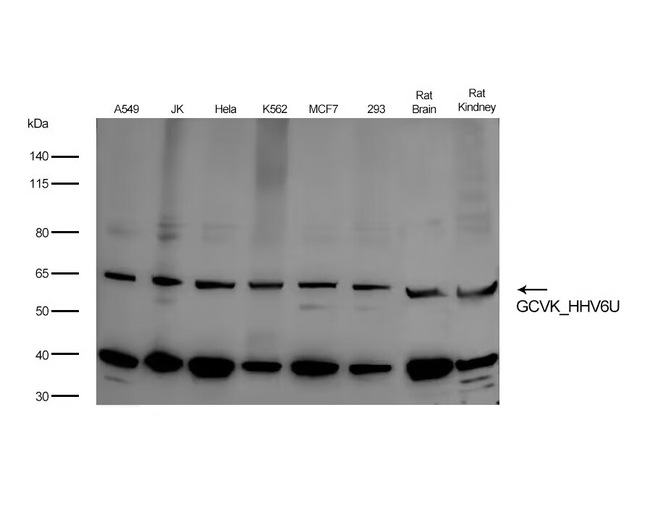HHV-6A U69 Antibody in Western Blot (WB)