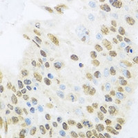 ZBTB17 Antibody in Immunohistochemistry (Paraffin) (IHC (P))