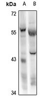 RBPJL Antibody in Western Blot (WB)